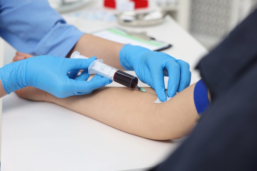 Alfa Feto Proteína (AFP)