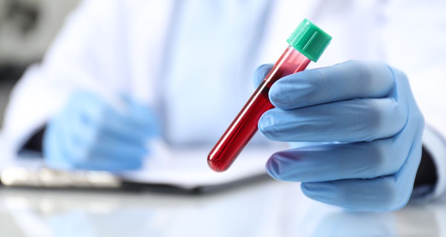 Anticuerpos Anti Citomegalovirus IGG