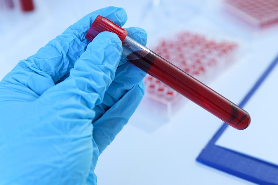 Colesterol de Alta Densidad (HDL)