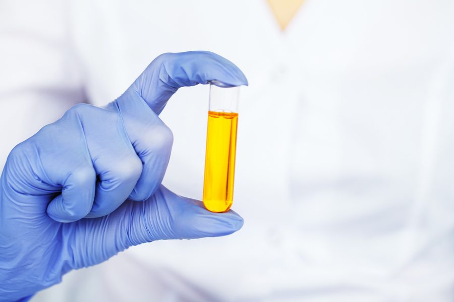 Glucosa en Orina de 24 Horas