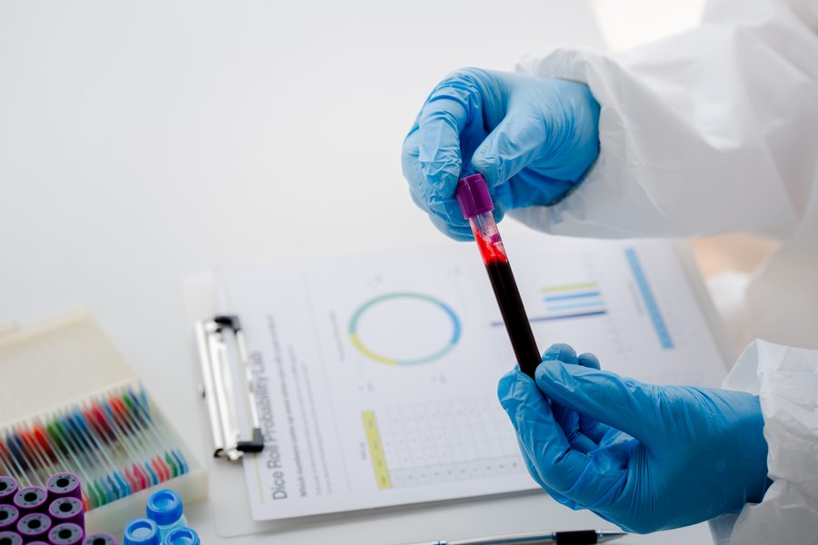 Lipoproteína de Baja Densidad (LDL)