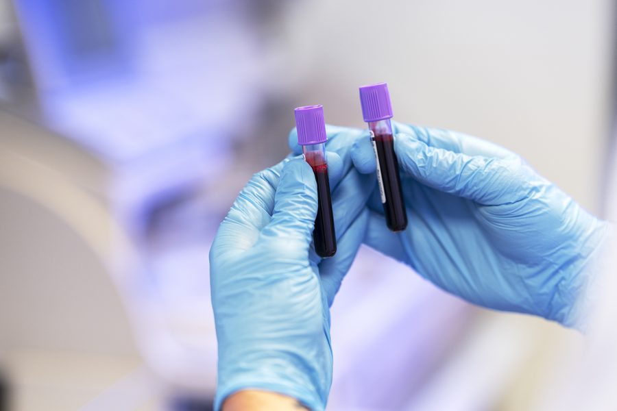 Perfil Bioquimico de 24 Elementos