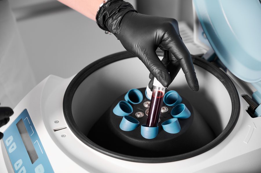 Perfil Torch IGG (tox Cmv Rub Hvs)