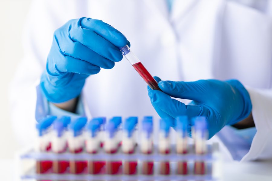 Proteína C Reactiva Ultra Sensible