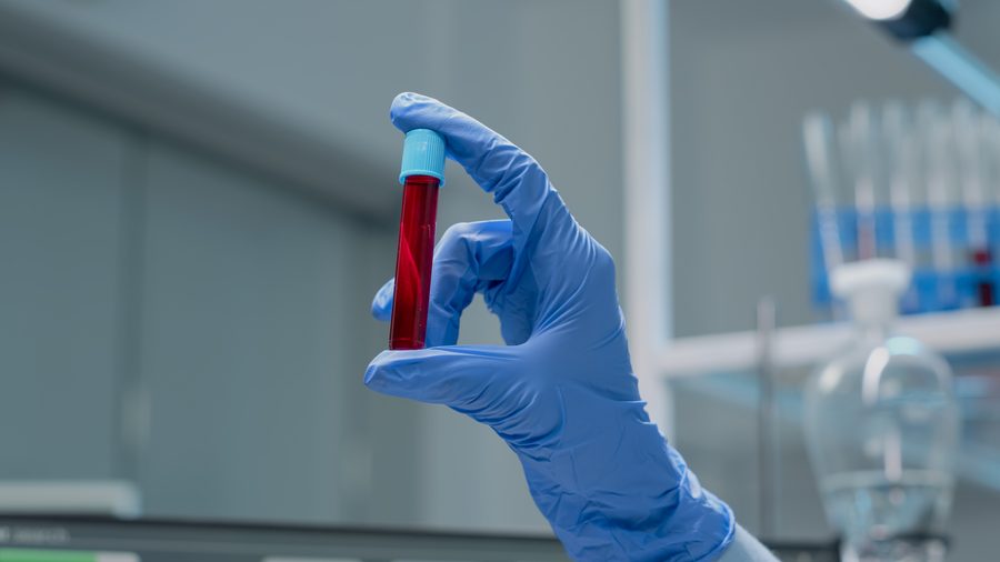 Tamiz de Glucosa Gestacional